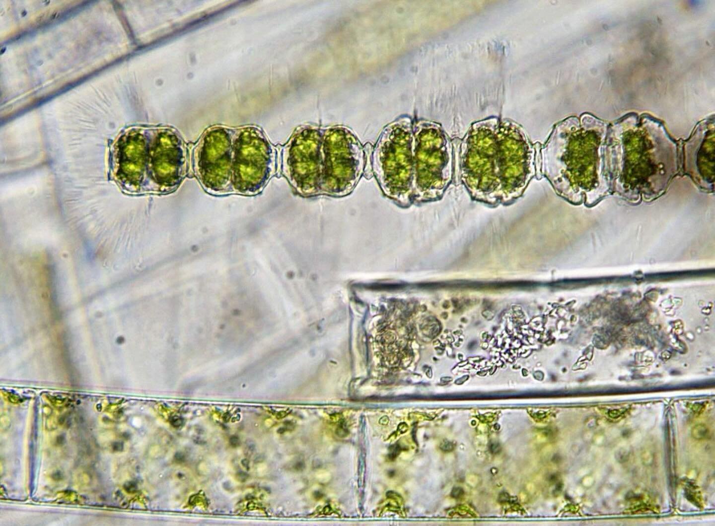 Filamentous green algae. 100x magnification. Brightfield.
.
I&rsquo;ll do another post in the future on complex multicellularity but here we have some good examples of algae with simple multicellularity. These cells exist as long filaments of many si