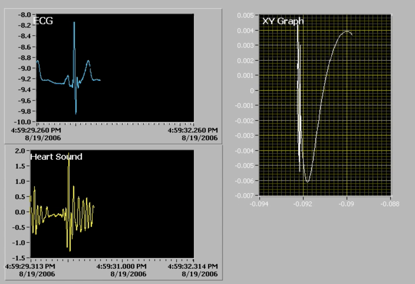 HeartSound_Screen Shot.png