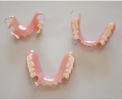 Partial Dentures Dinos Denture Clinic Partial Dentures Dinos Denture Clinic