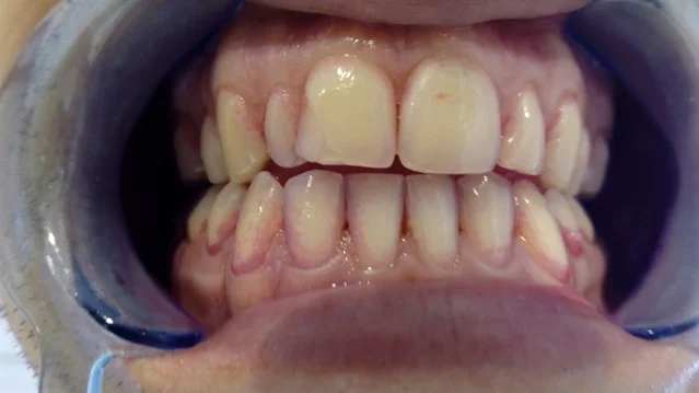 d87dbb75f6c09aa7492ec3c8954b370f_original.jpg