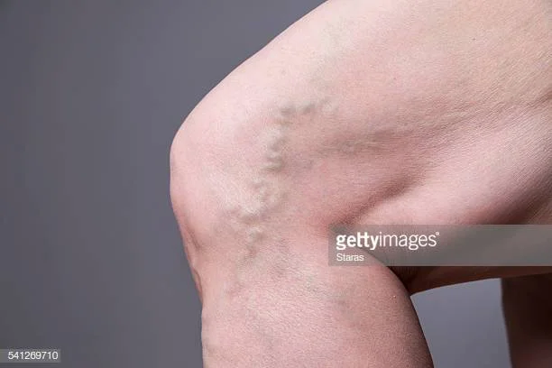 Photo by Staras/iStock / Getty Images