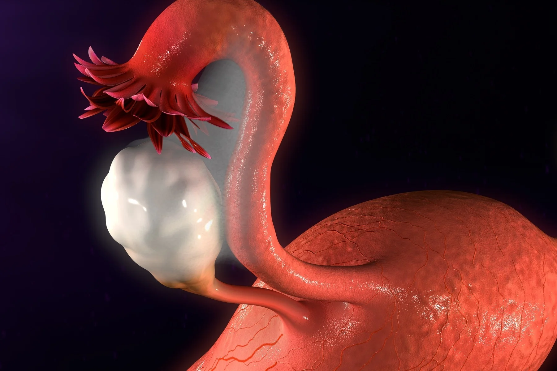 endometriose.jpg