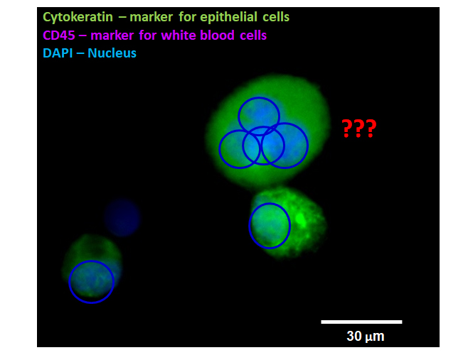 polyploid cell a CTC (665x500).2 copy.jpg