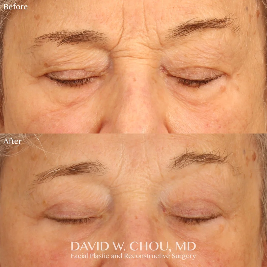 zoomed eyes closed top bottom.jpg