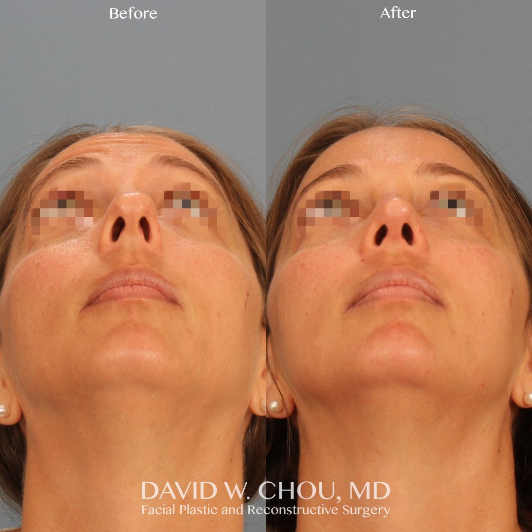 base view blurred.jpg