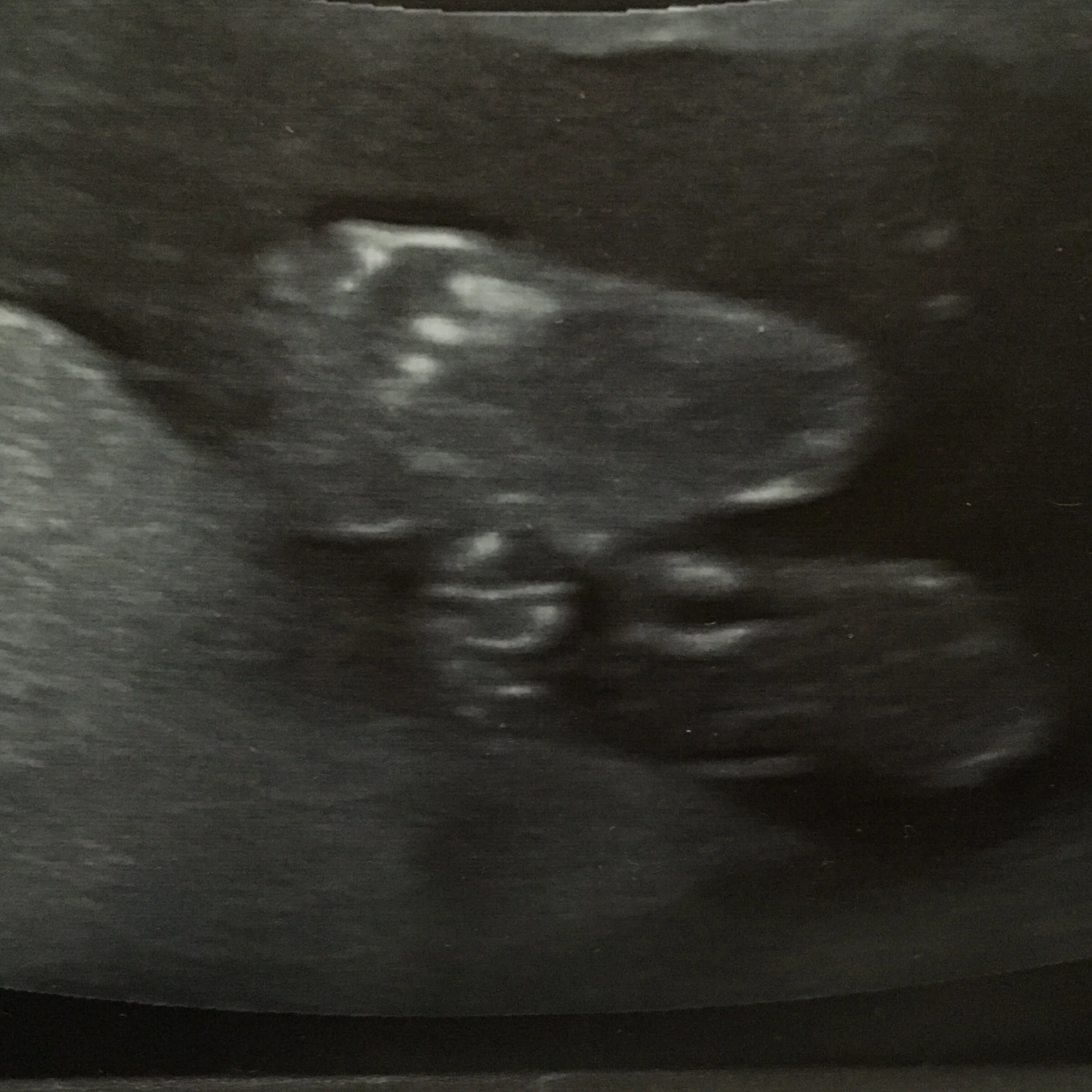 Little by little (feet)