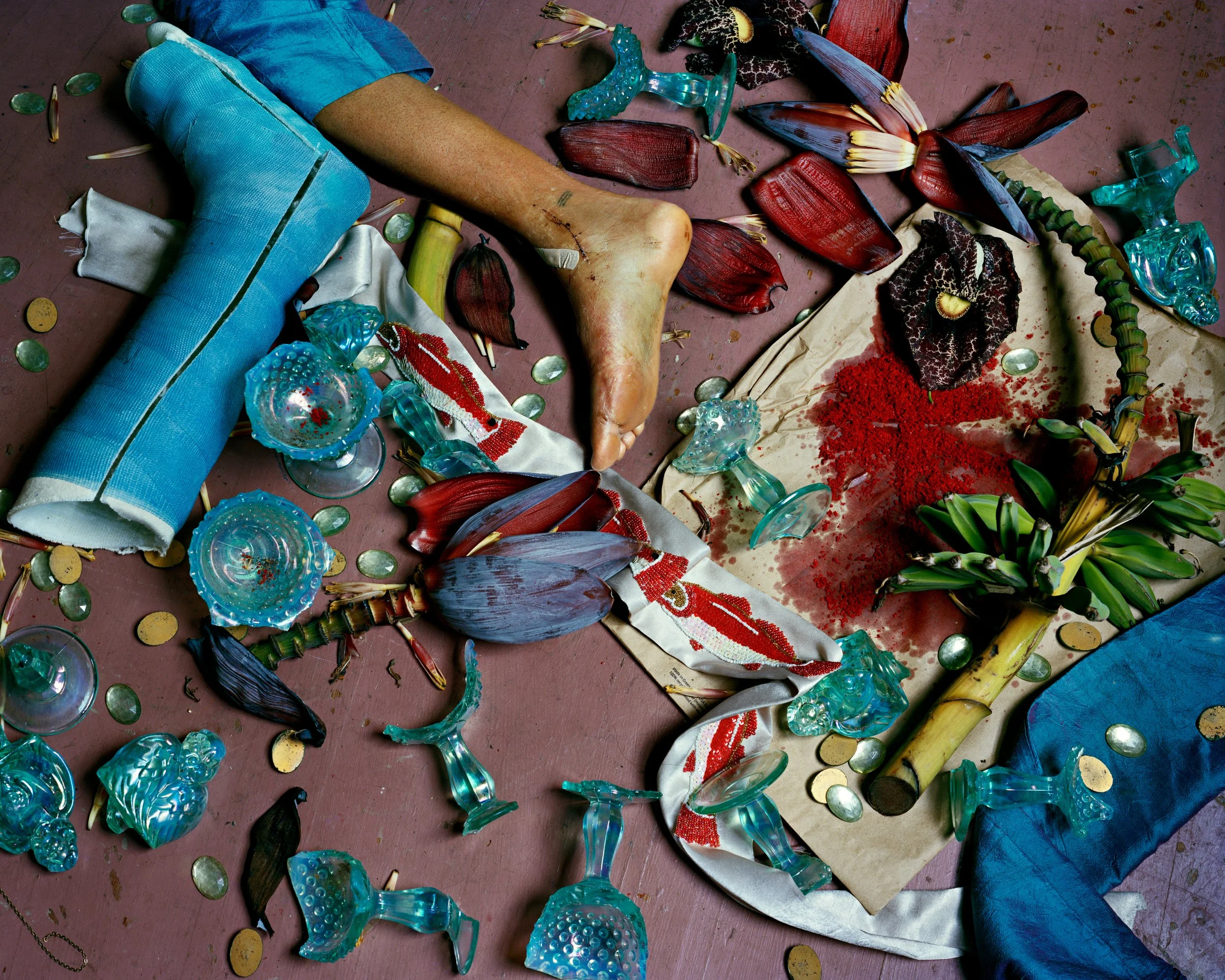 Soleil with Injury from Mardi Gras Day