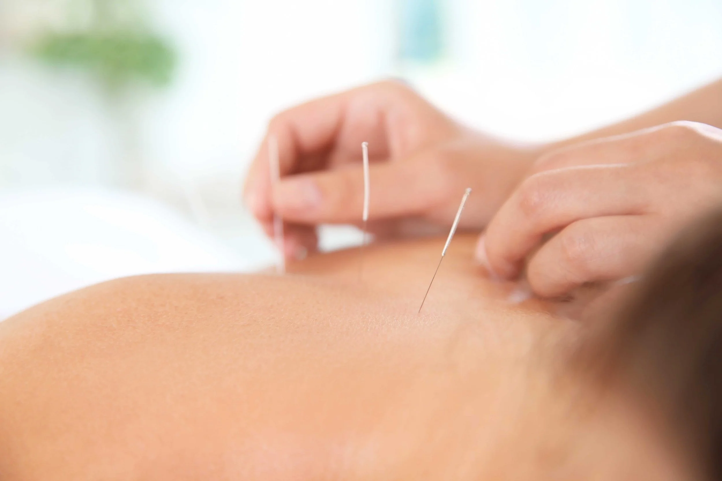Effective Acupuncture for Fertility—Proven Outcomes and Patient Satisfaction.jpg