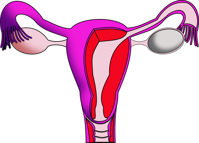September is PCOS Awareness Month