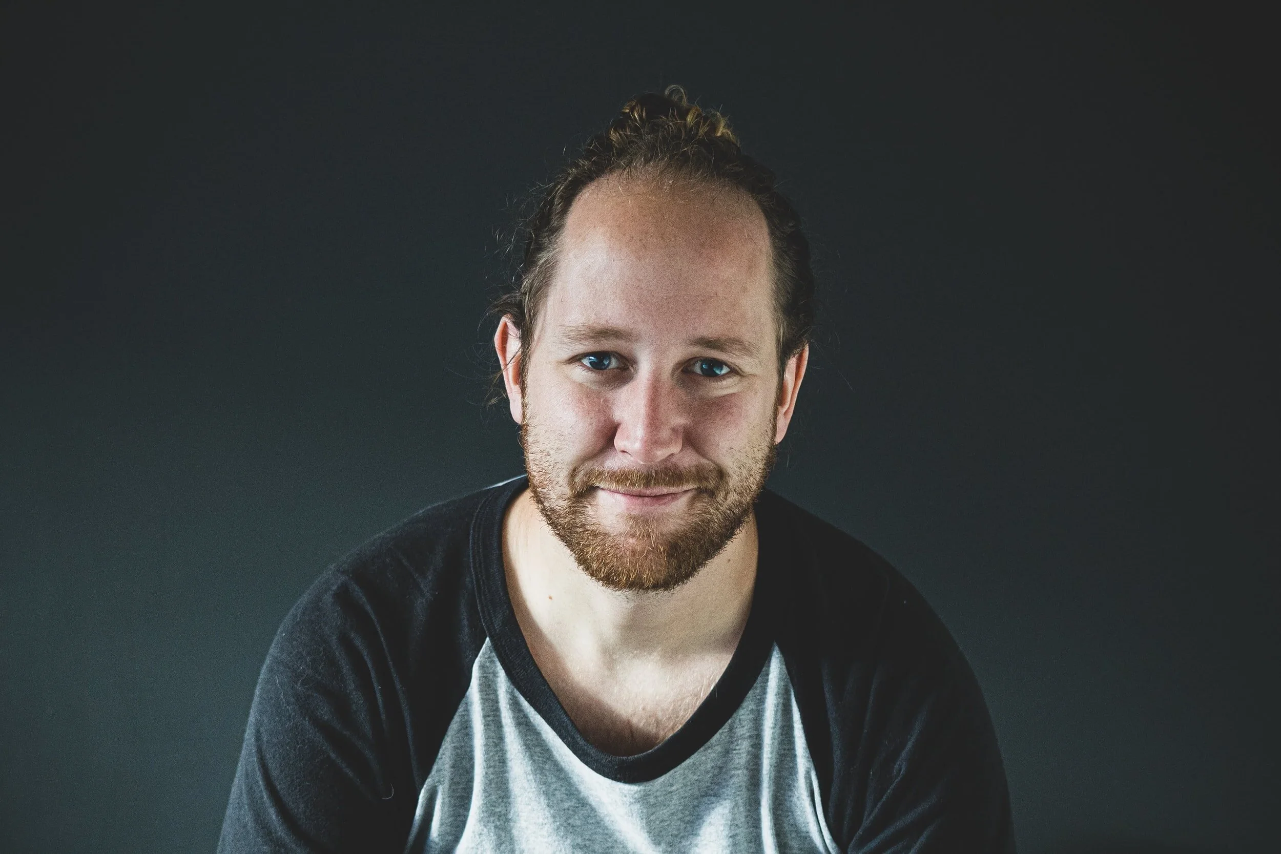 PCOS In Men? Yes, Researcher Confirm