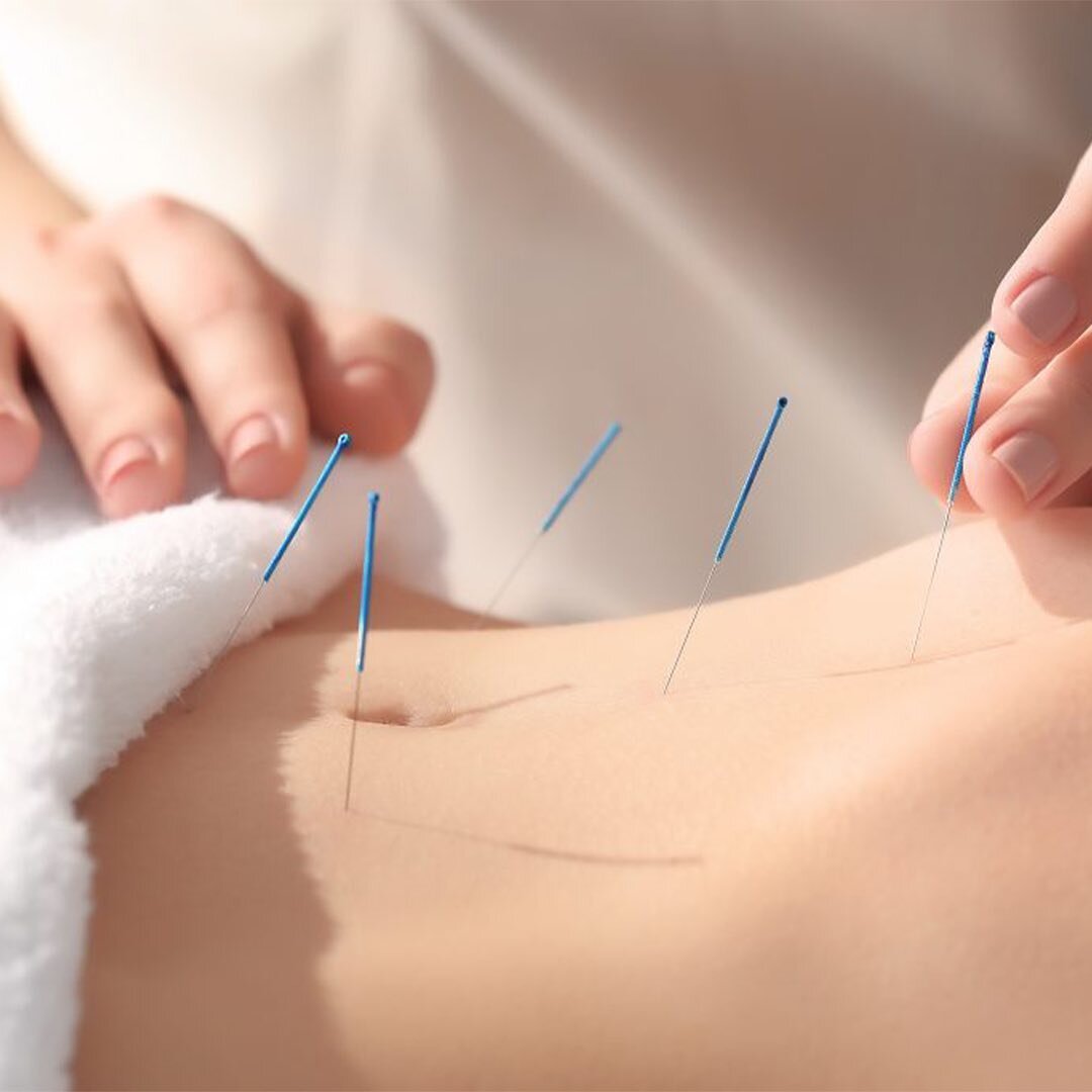 Acupuncture Benefits for FERTILITY
1. Improves circulation reproductive organs
2. Supports Healthy Eggs &amp; Sperm
3. Helps regulate hormones
4. Supports Ovulation
5. Reduces Stress
6. Supports IVF

To book your CONSULTATION, you can click the link 
