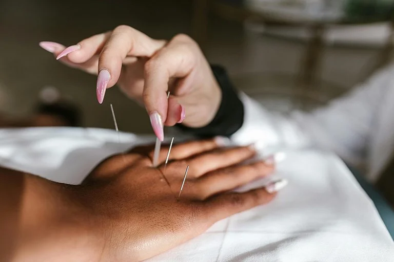 Acupuncture in Toronto: Bridging the Gap Between Traditional and Modern Fertility Care