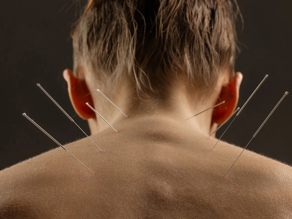 Why Does It Matter? 7 Ways Acupuncture Can Boost the Reproductive Health of Women in Their 20s