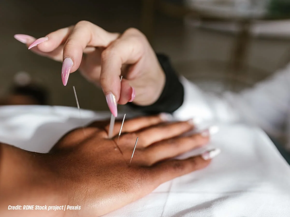 What Should I Do to Prepare for Menopause? 7 Common Questions Answered (And How Acupuncture Can Help)