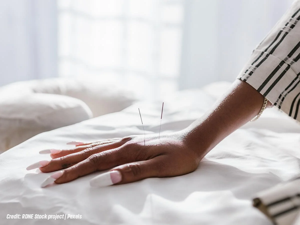How Acupuncture Can Help Prepare for and Manage Menopause