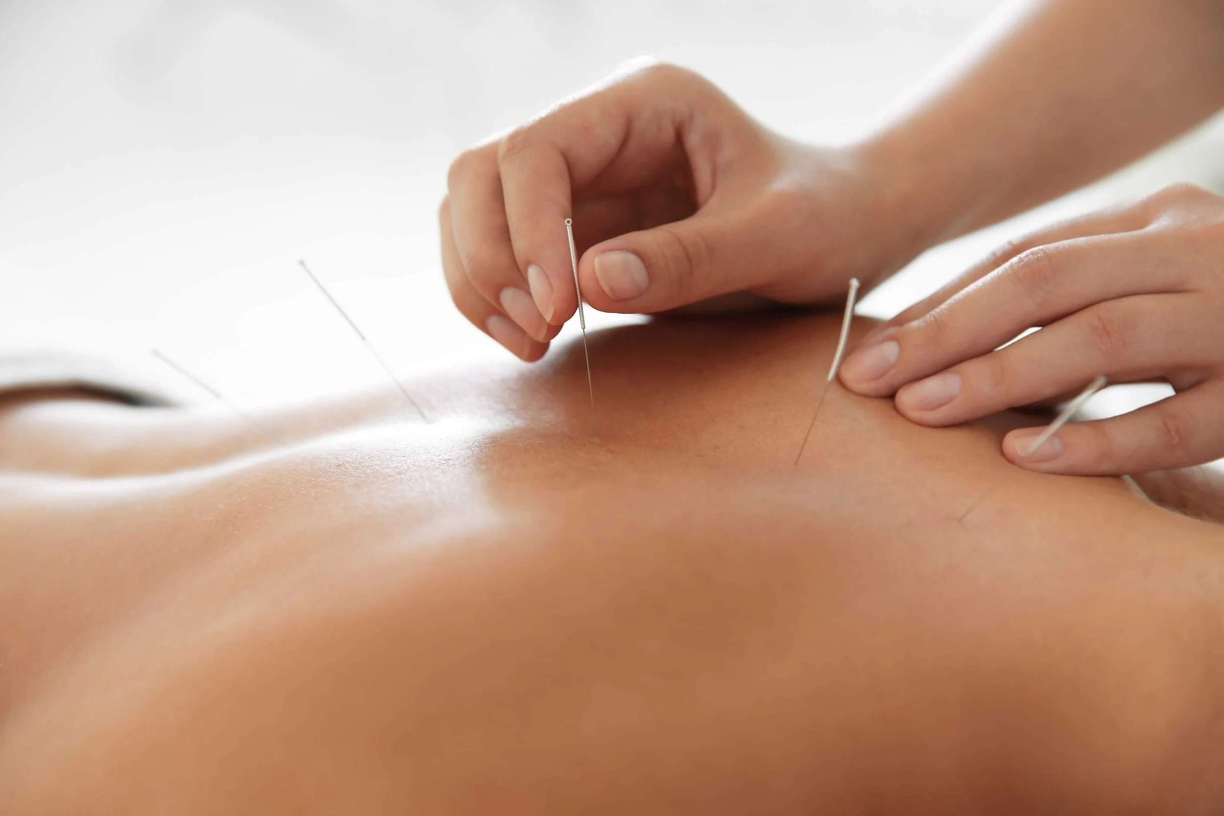 Effective Acupuncture for Fertility—High Success Rate and Patient Satisfaction.jpg