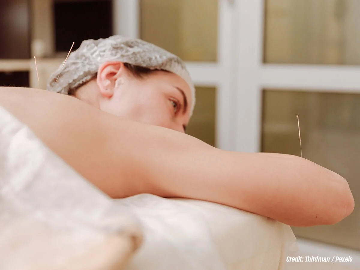 What This Means for Acupuncture Treatment