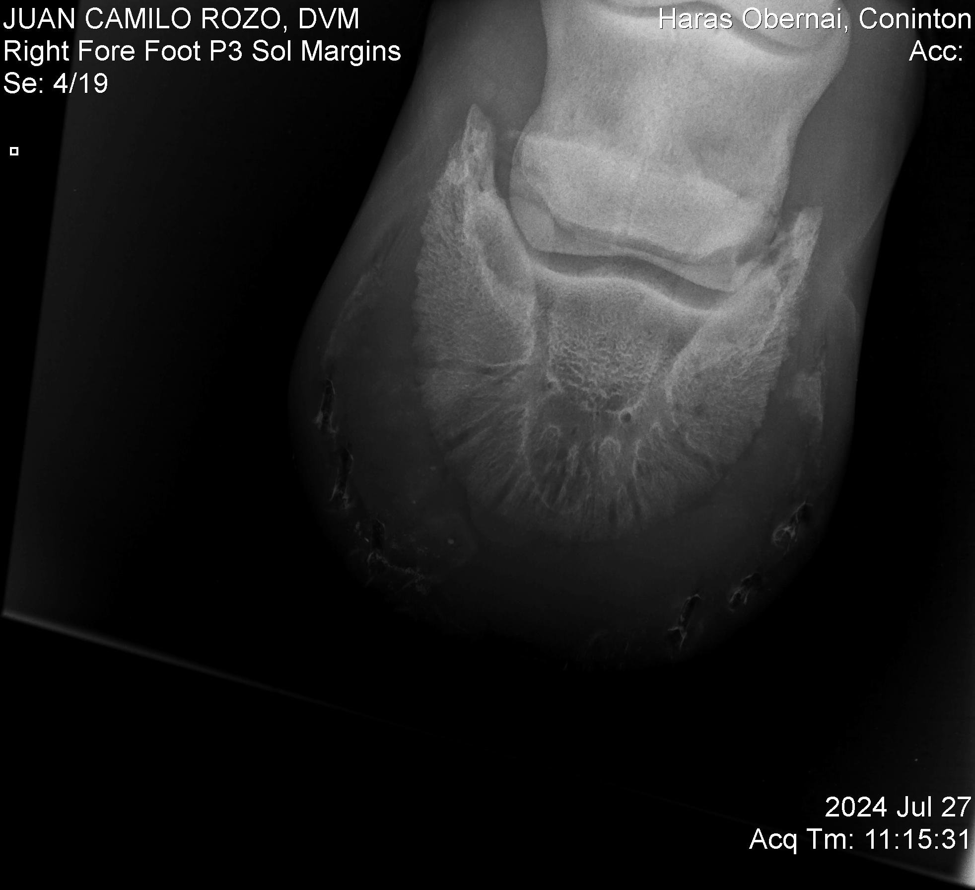 Navicular Der.jpg