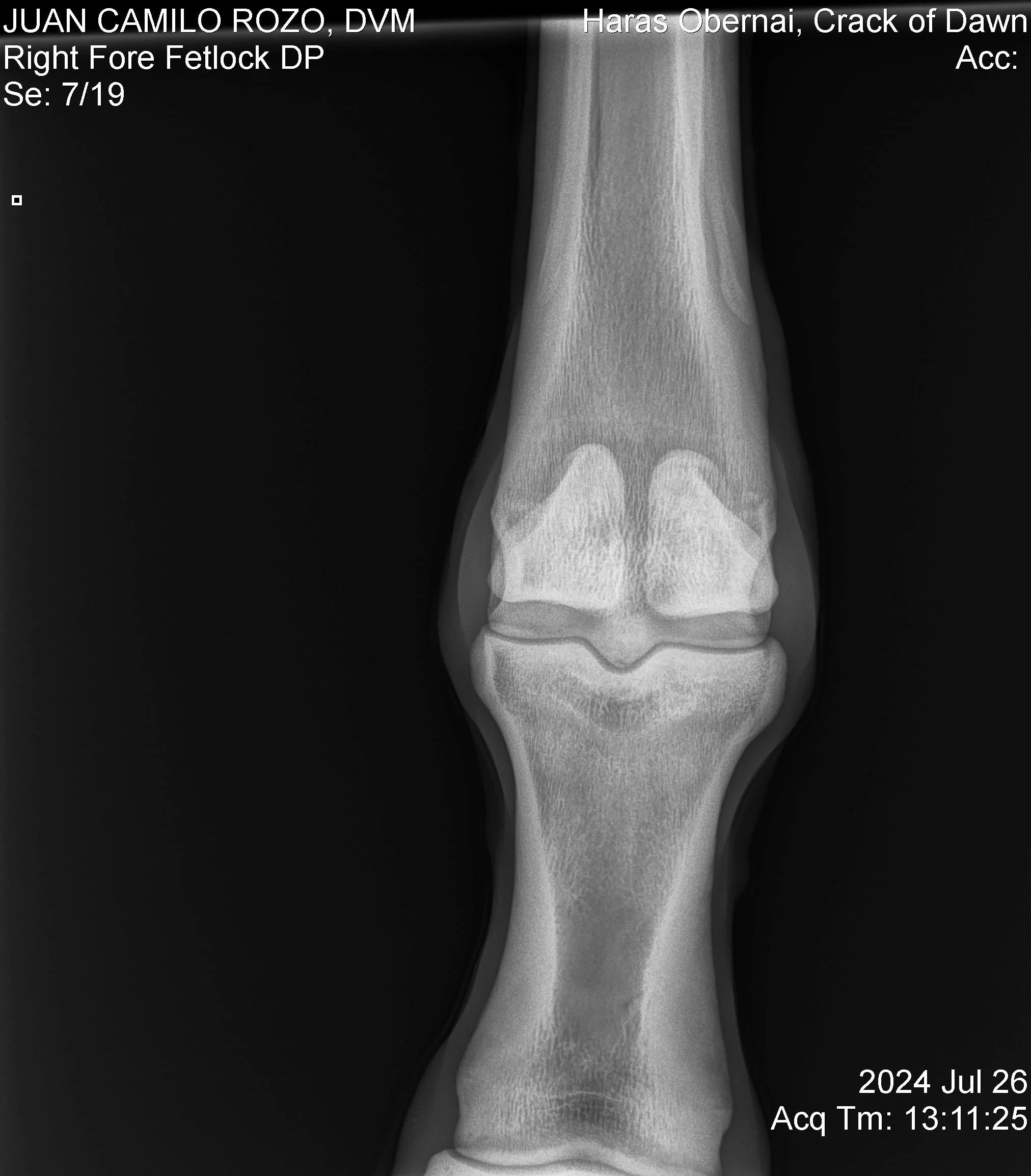 Nudo anterior Der DP.jpg