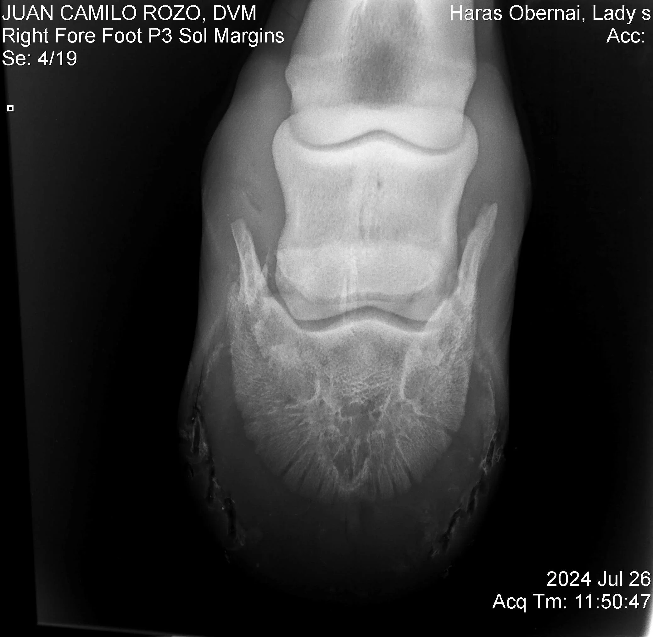 Navicular Der.jpg
