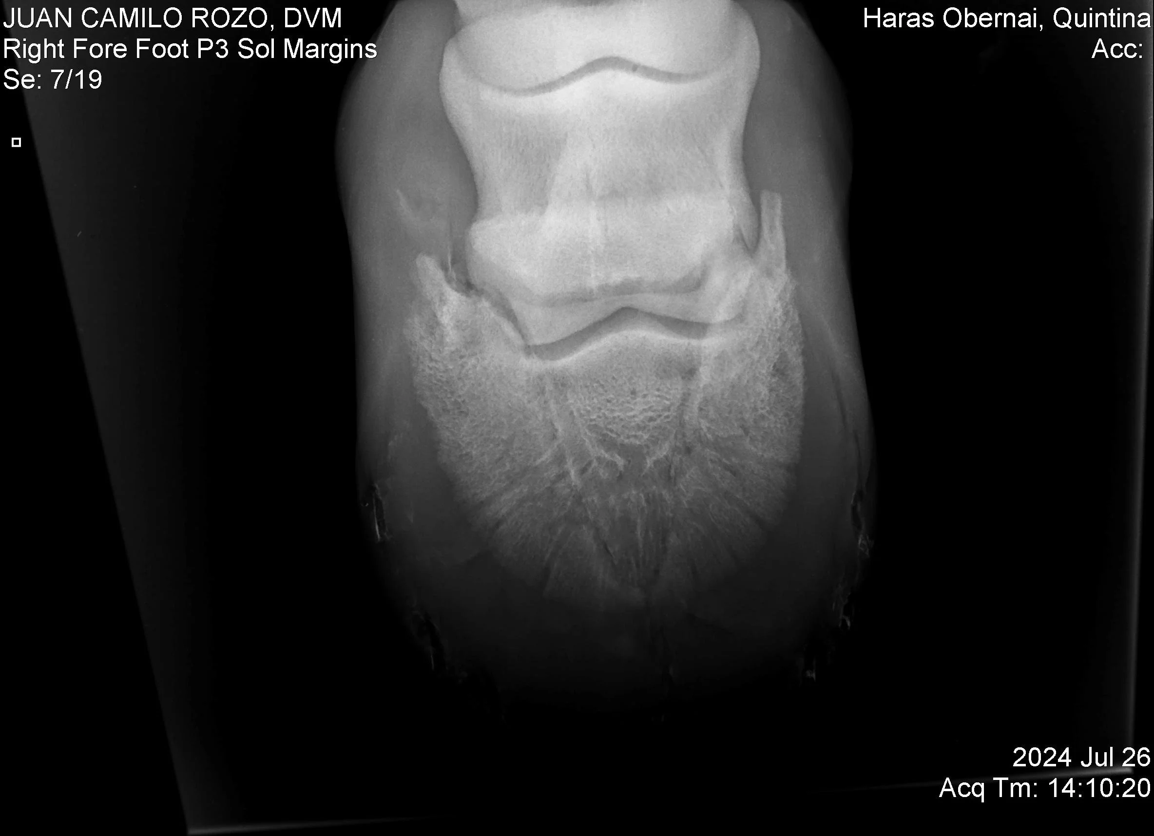Navicular Der.jpg