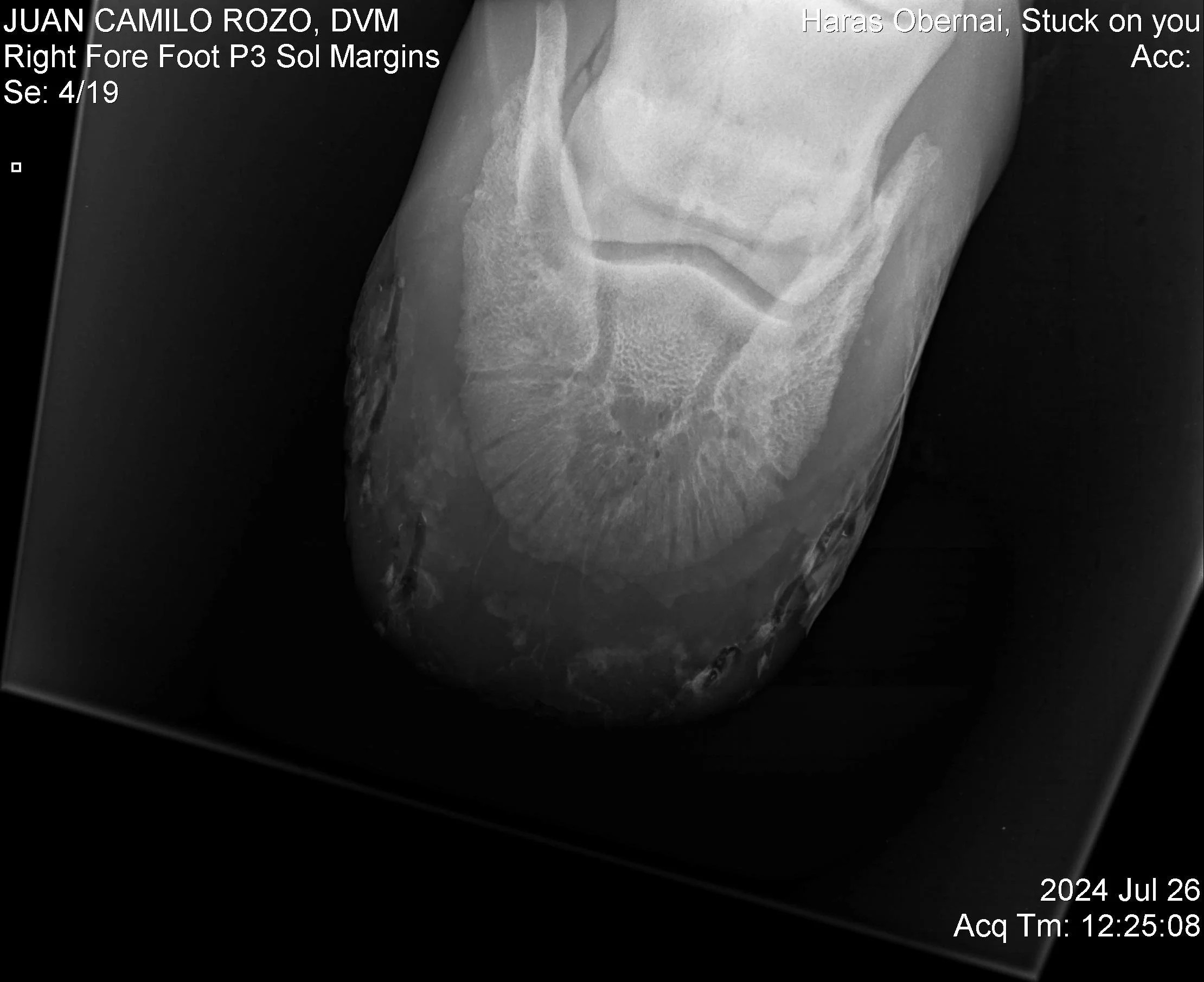 Navicular Der.jpg