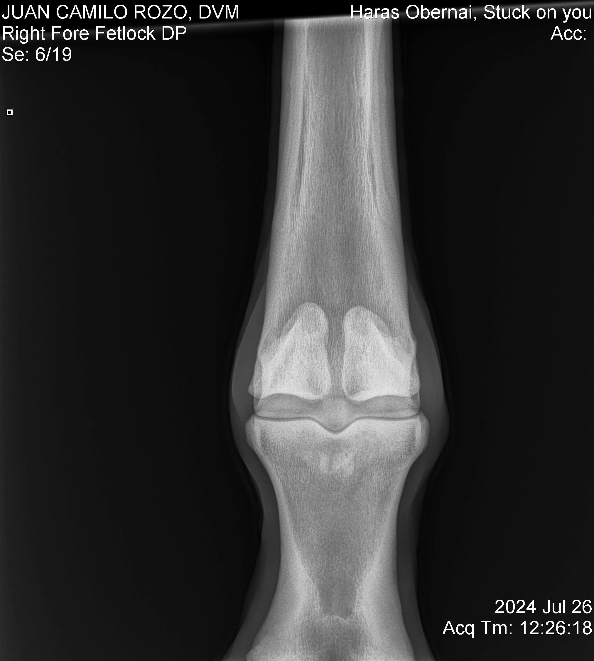 Nudo anterior Der DP.jpg