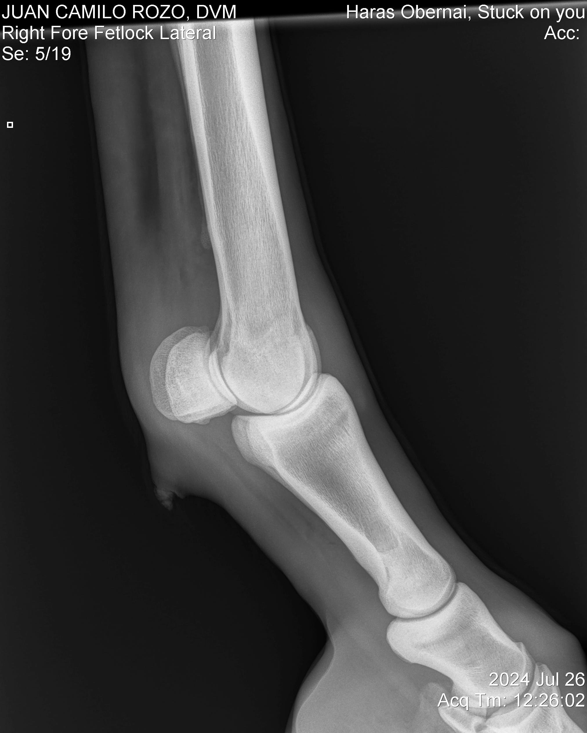 Nudo anterior Der LL.jpg