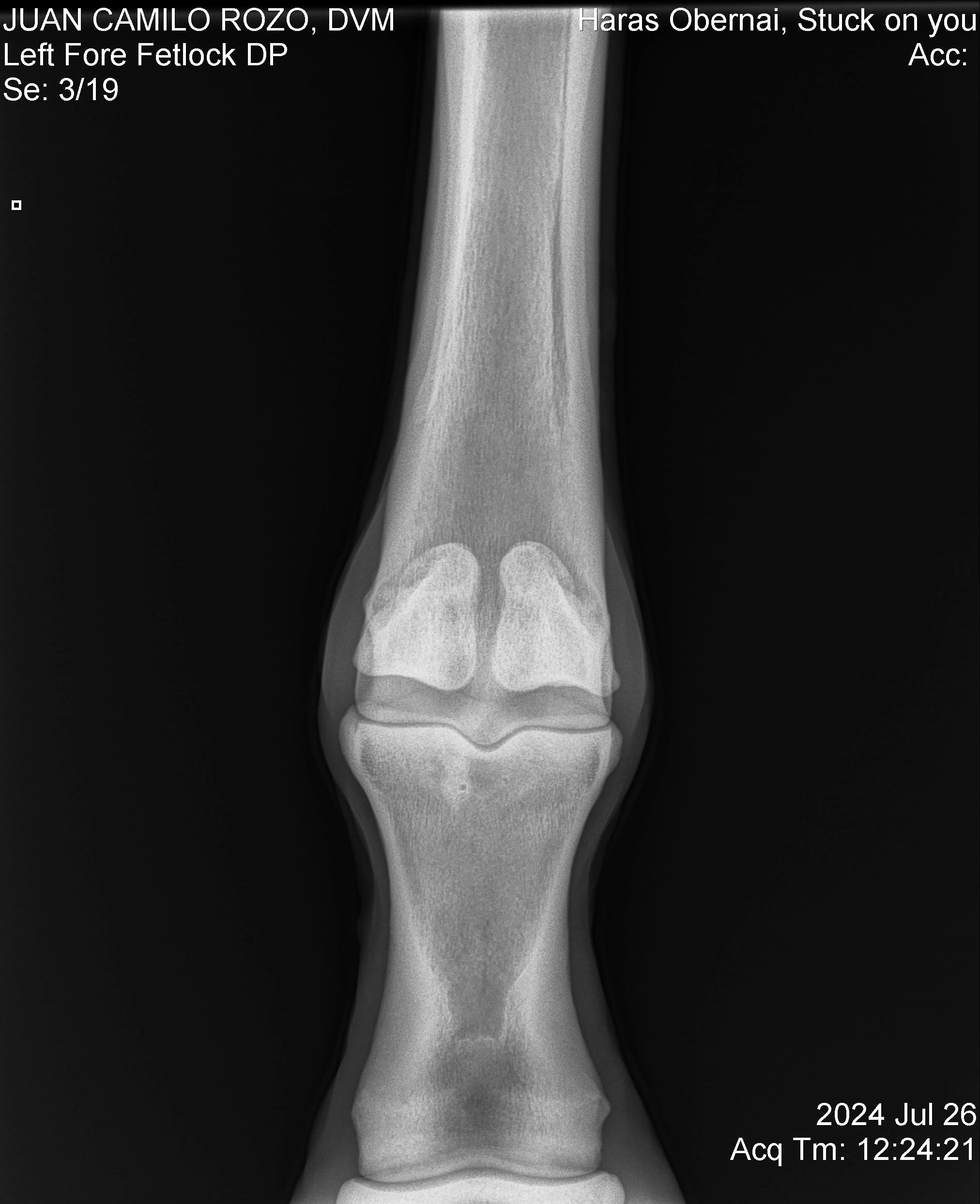 Nudo anterior izq DP.jpg