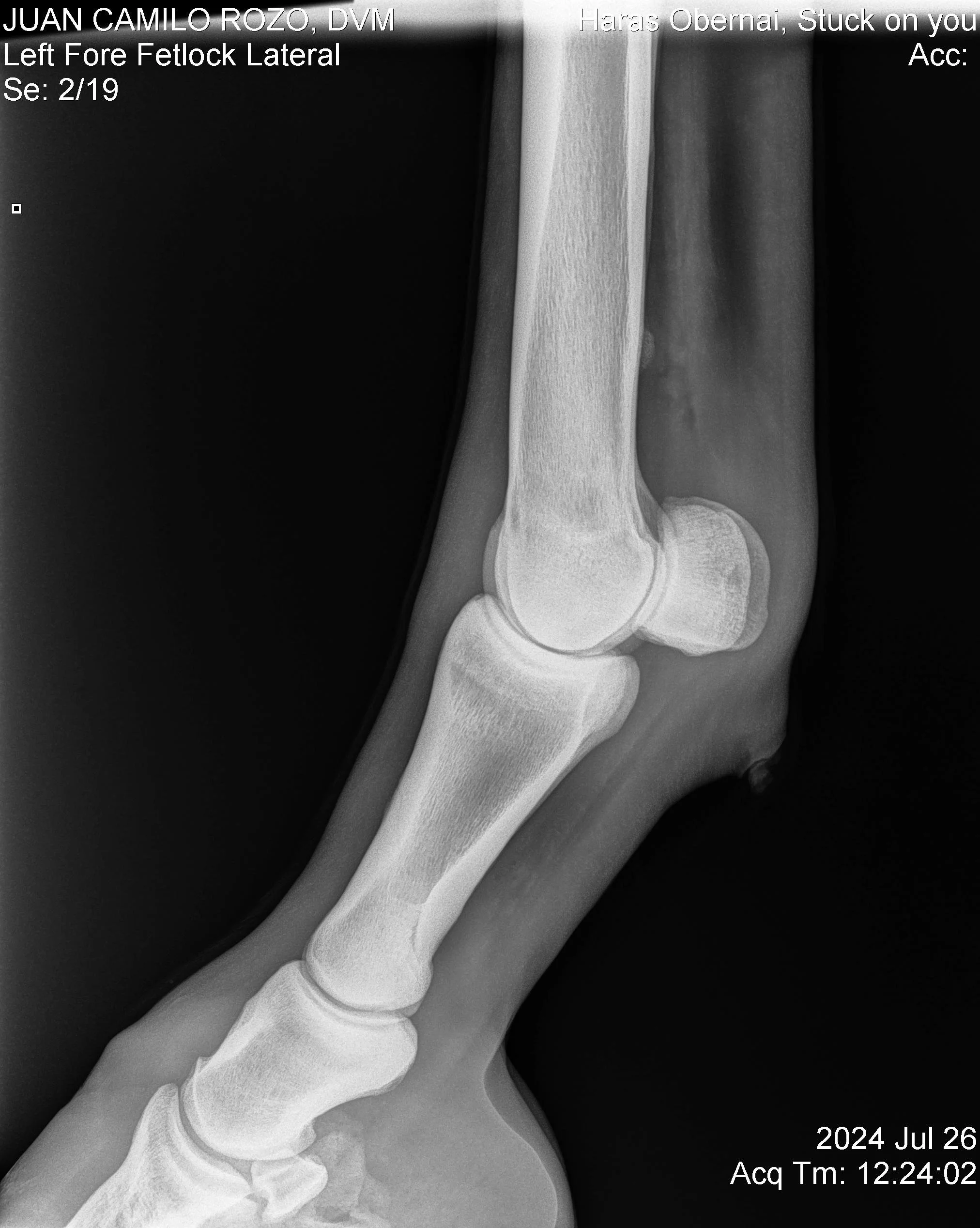 Nudo anterior izq LL.jpg