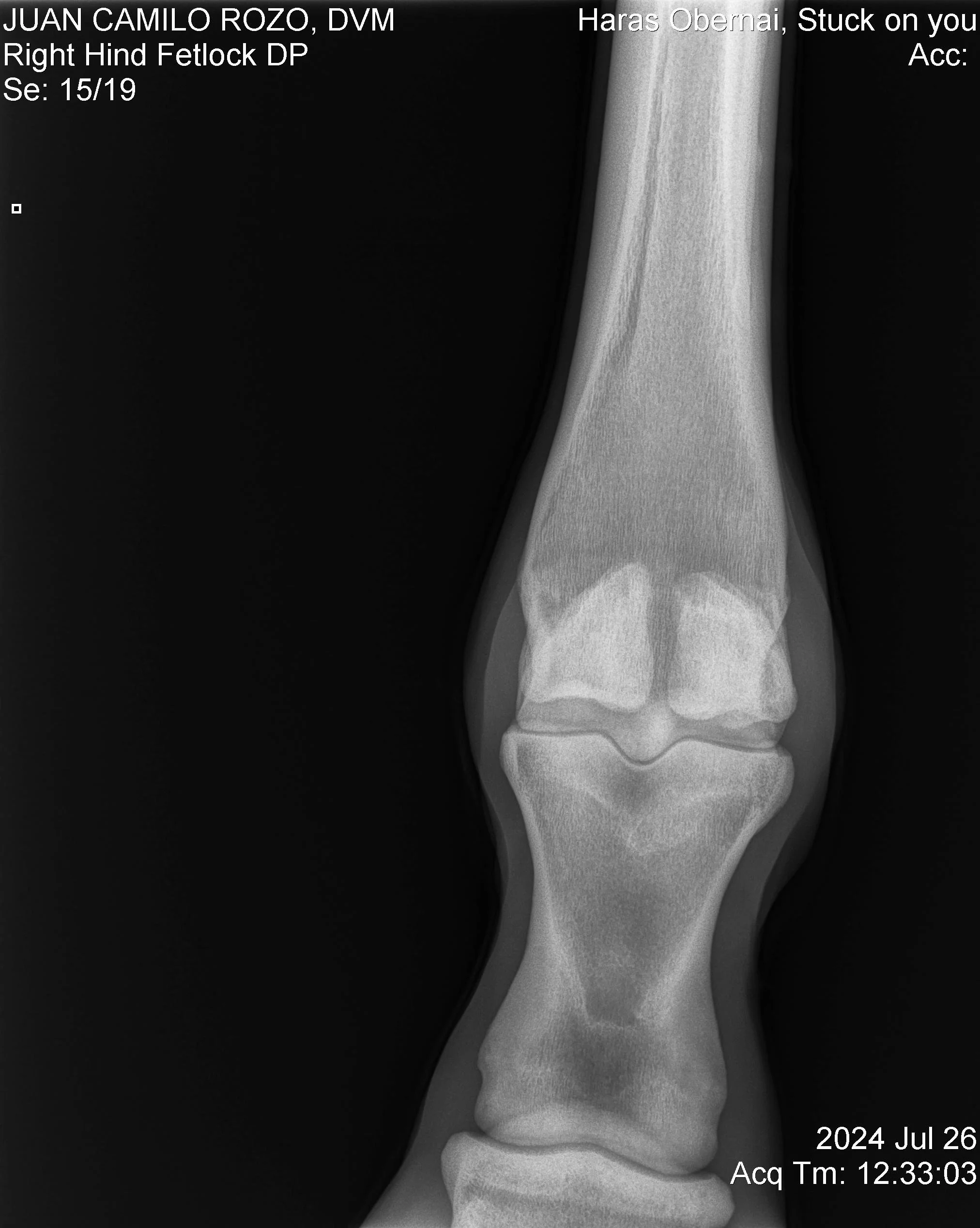 Nudo posterior Der DP.jpg