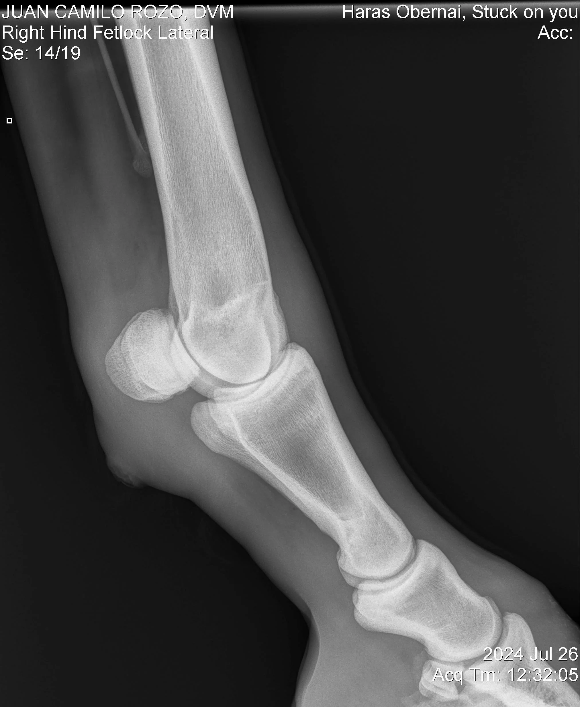 Nudo posterior Der LL.jpg