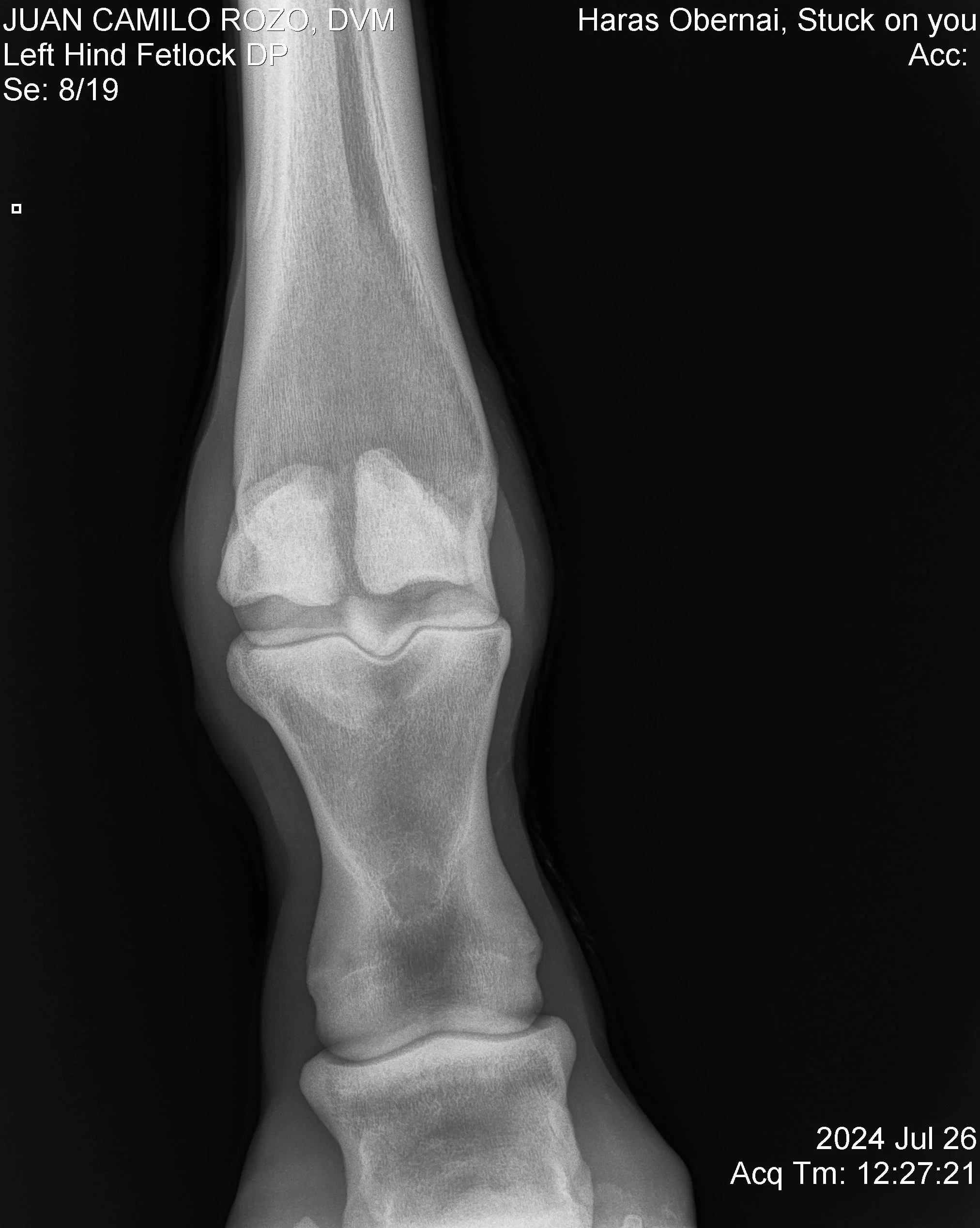 Nudo posterior izq DP.jpg