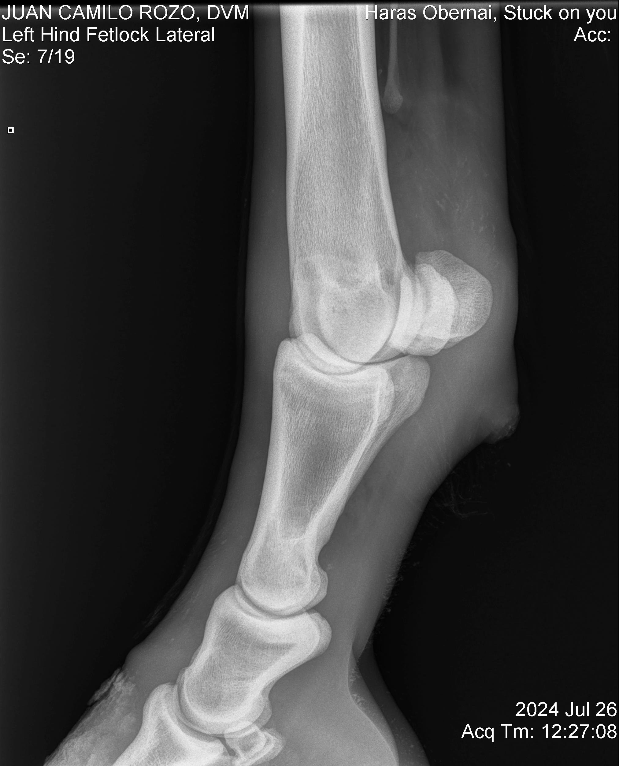 Nudo posterior izq LL.jpg