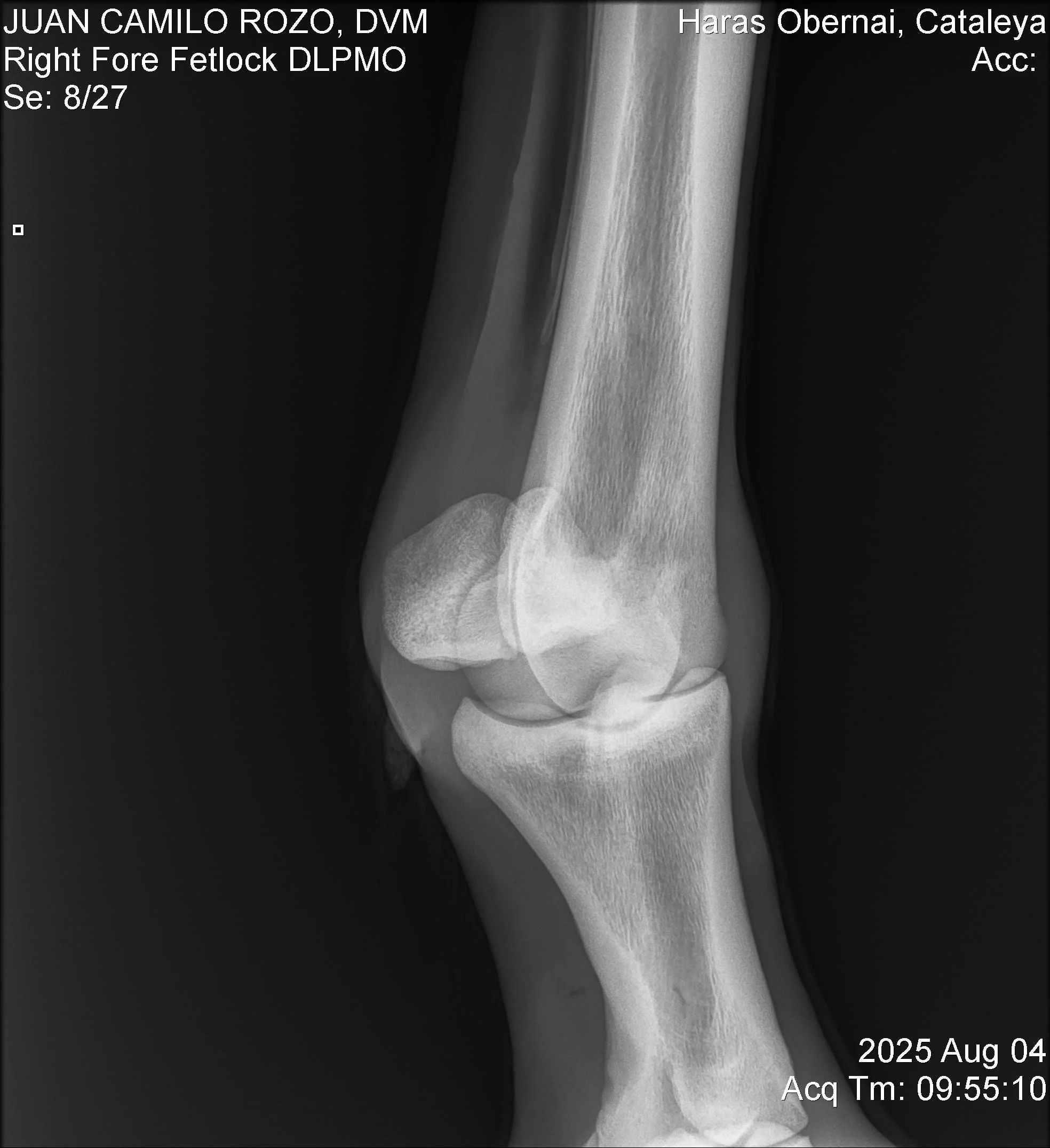 Right Fore Fetlock DLPMO.jpg
