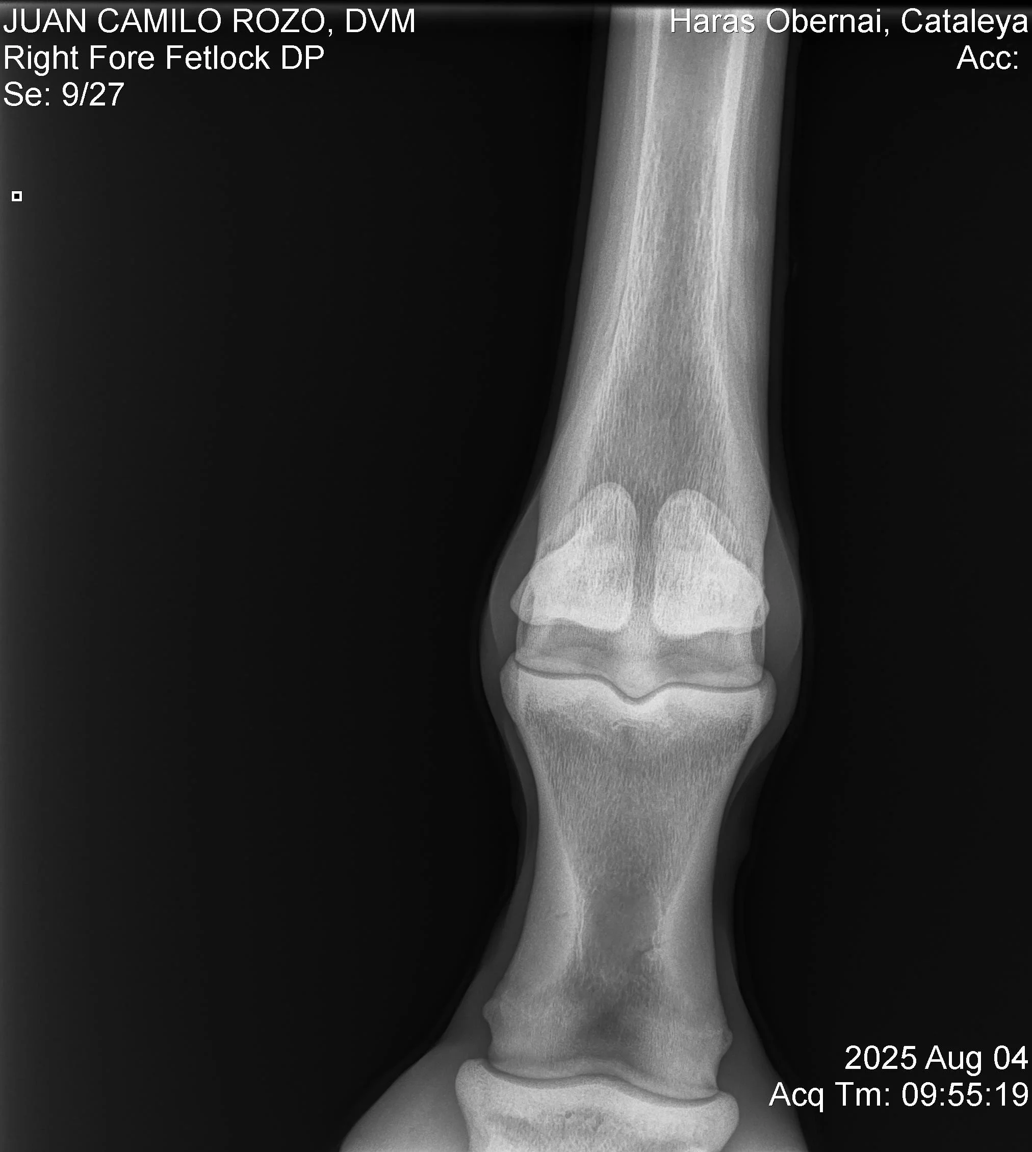 Right Fore Fetlock DP.jpg