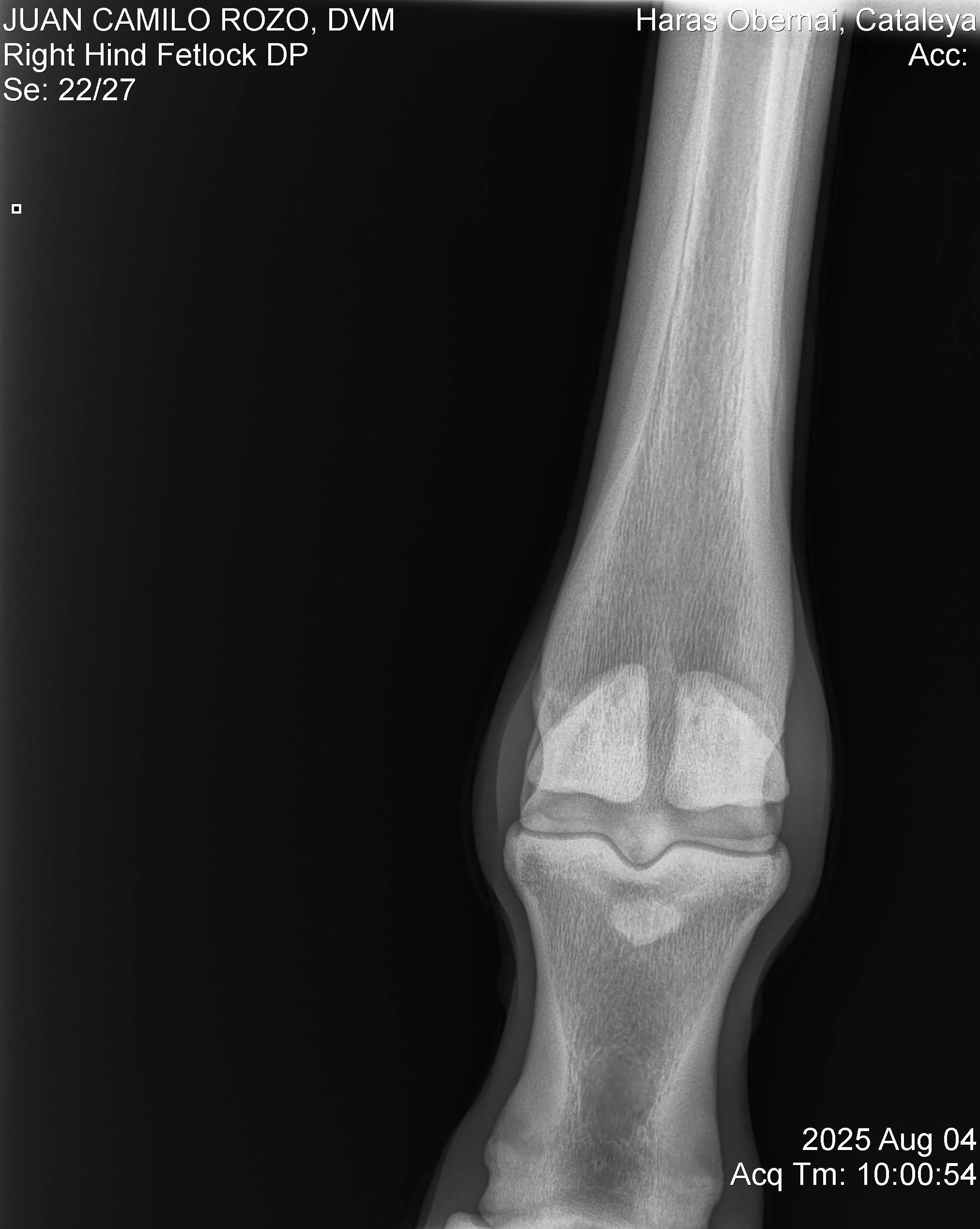 Right Hind Fetlock DP.jpg