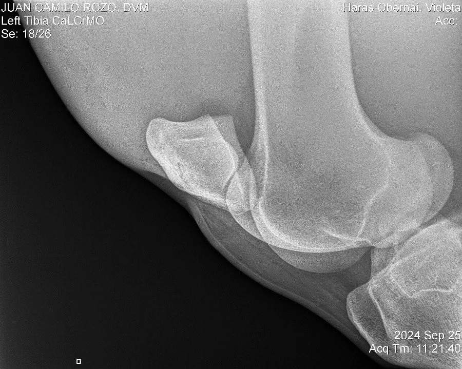 Left Tibia CaLCrMO.jpg