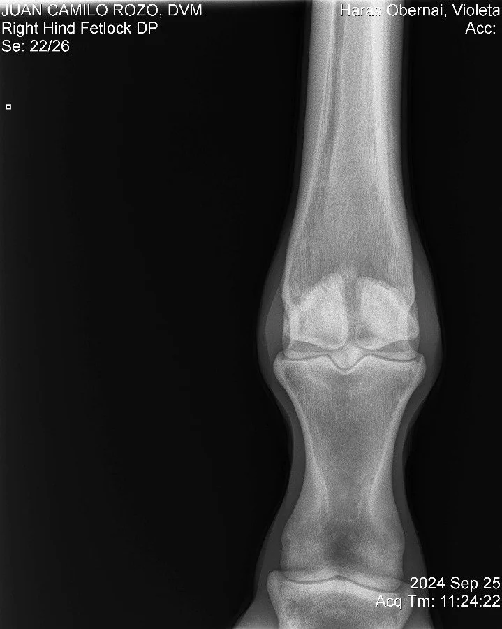 Right Hind Fetlock DP.jpg
