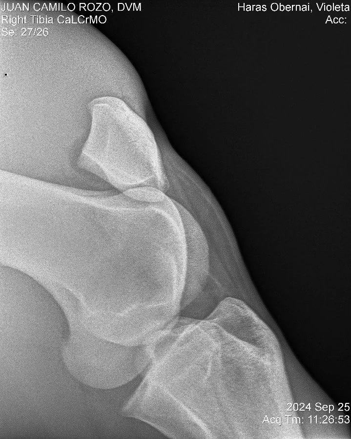 Right Tibia CaLCrMO.jpg