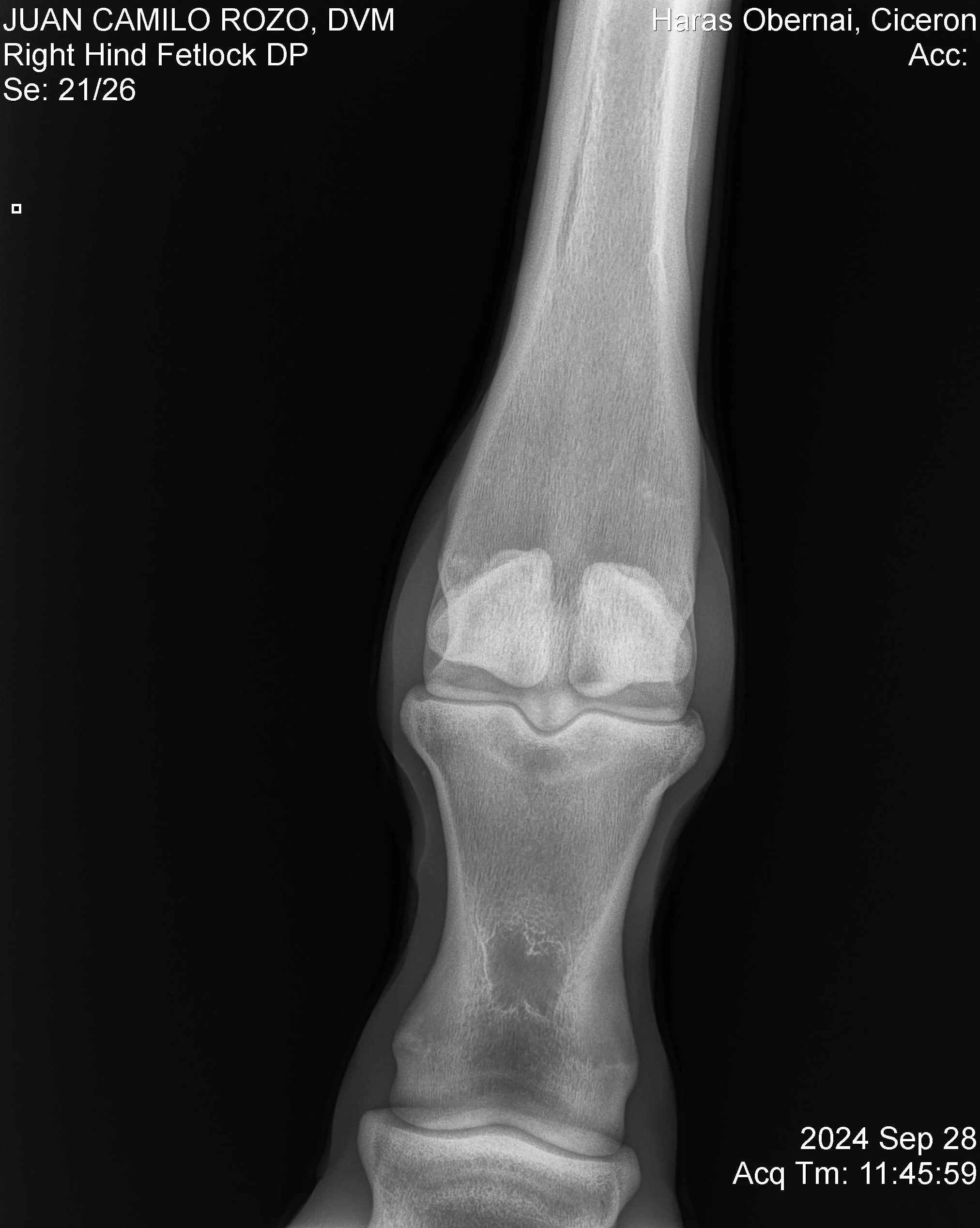 Right Hind Fetlock DP.jpg