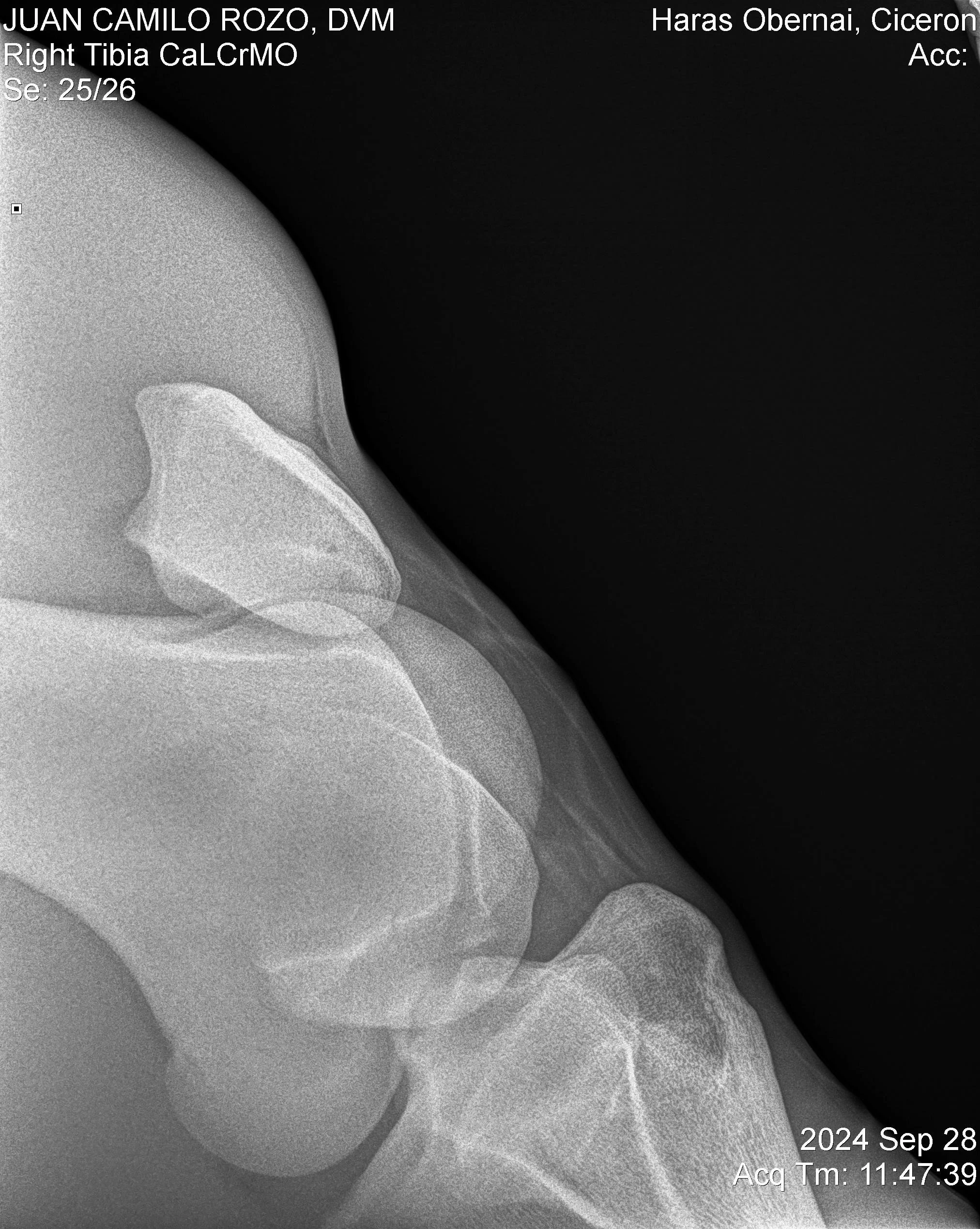 Right Tibia CaLCrMO.jpg
