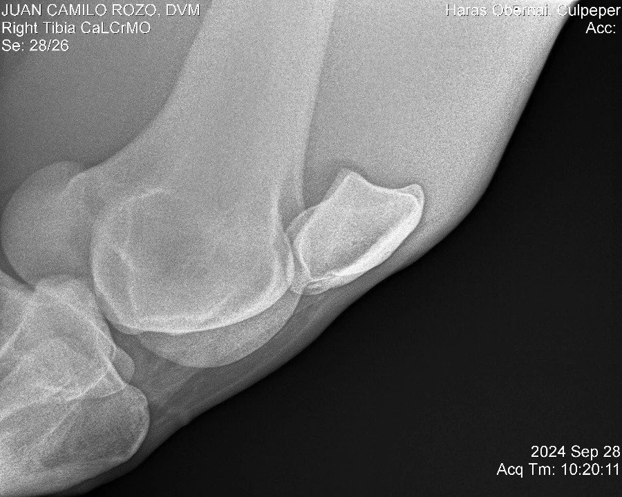 Righ Tibia CaLCrMO.jpg
