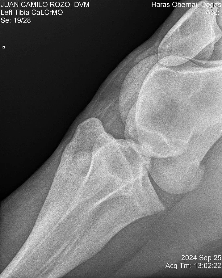 Left Tibia CaLCrMO.jpg