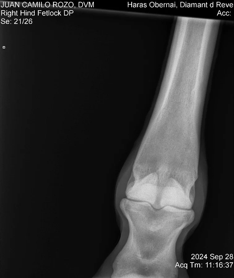 Right Hind Fetlock DP.jpg