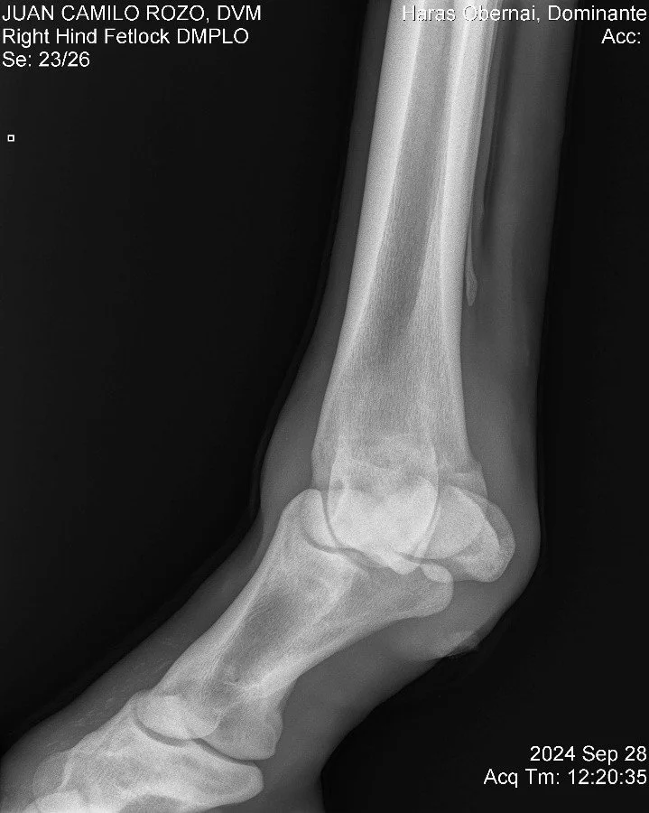 Right Hind Fetlock DMPLO.jpg