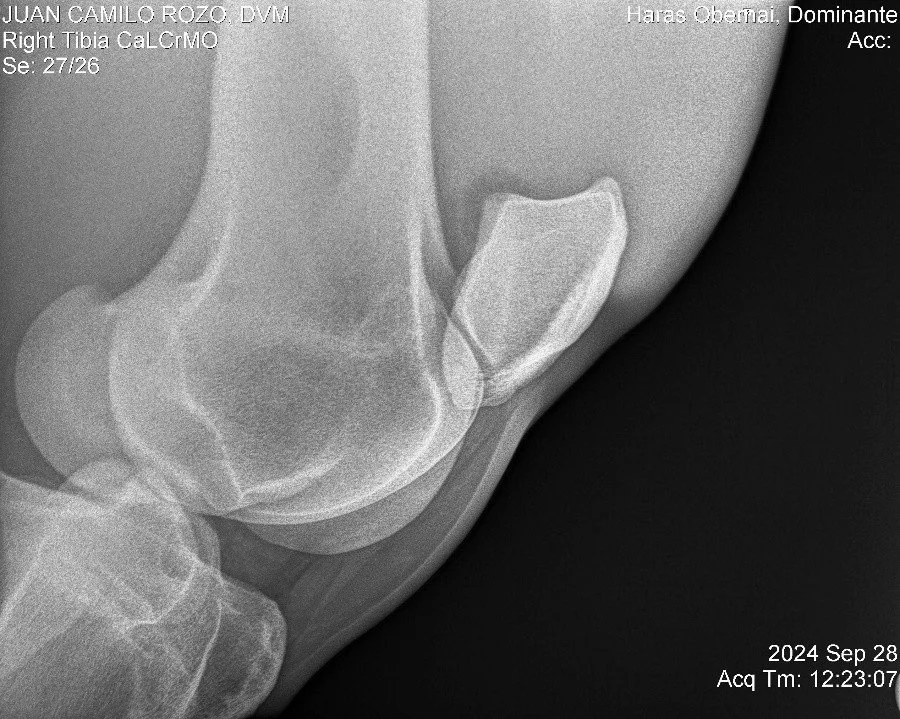 Right Tibia CaLCrMO.jpg