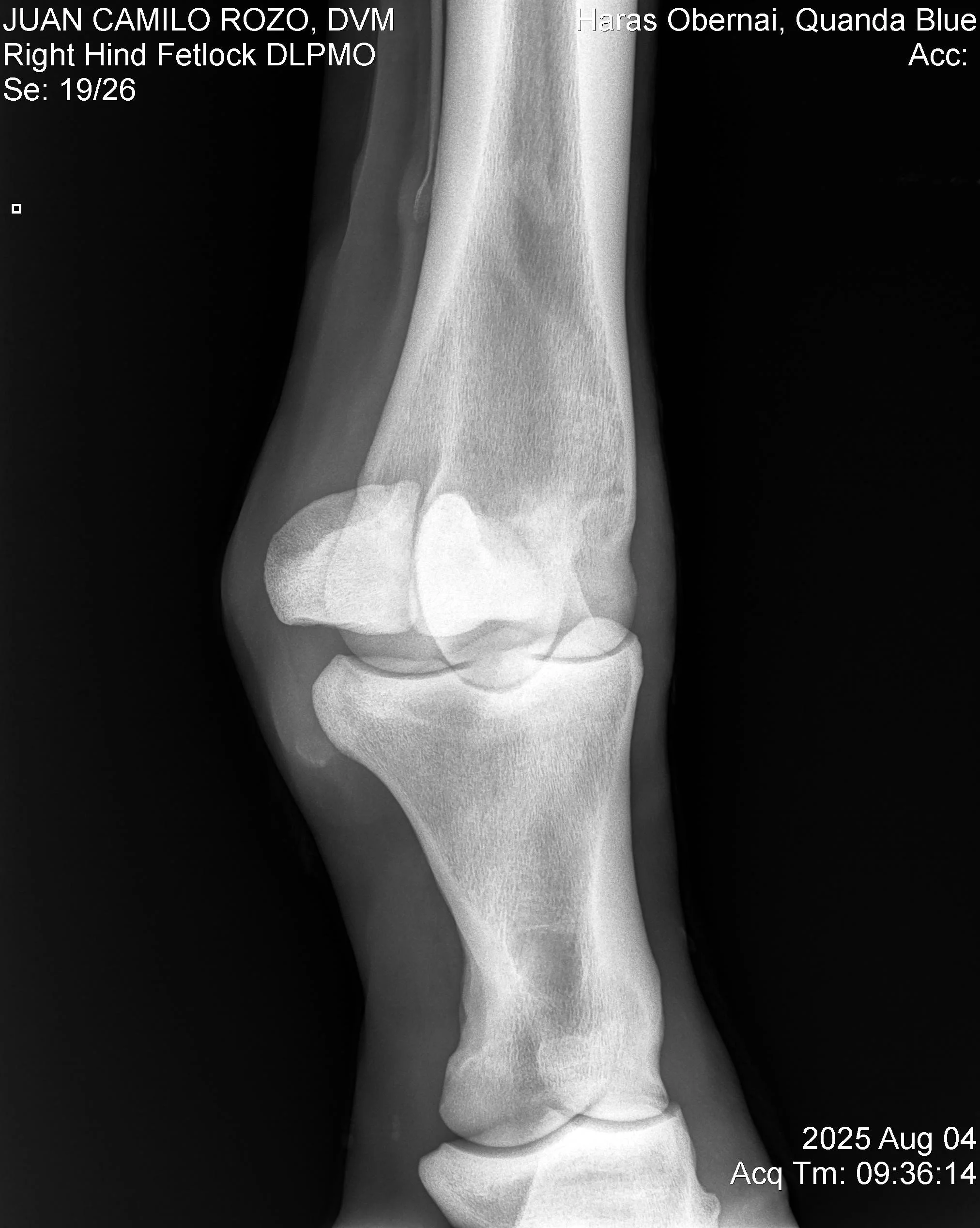 Right Hind Fetlock DLPMO.jpg
