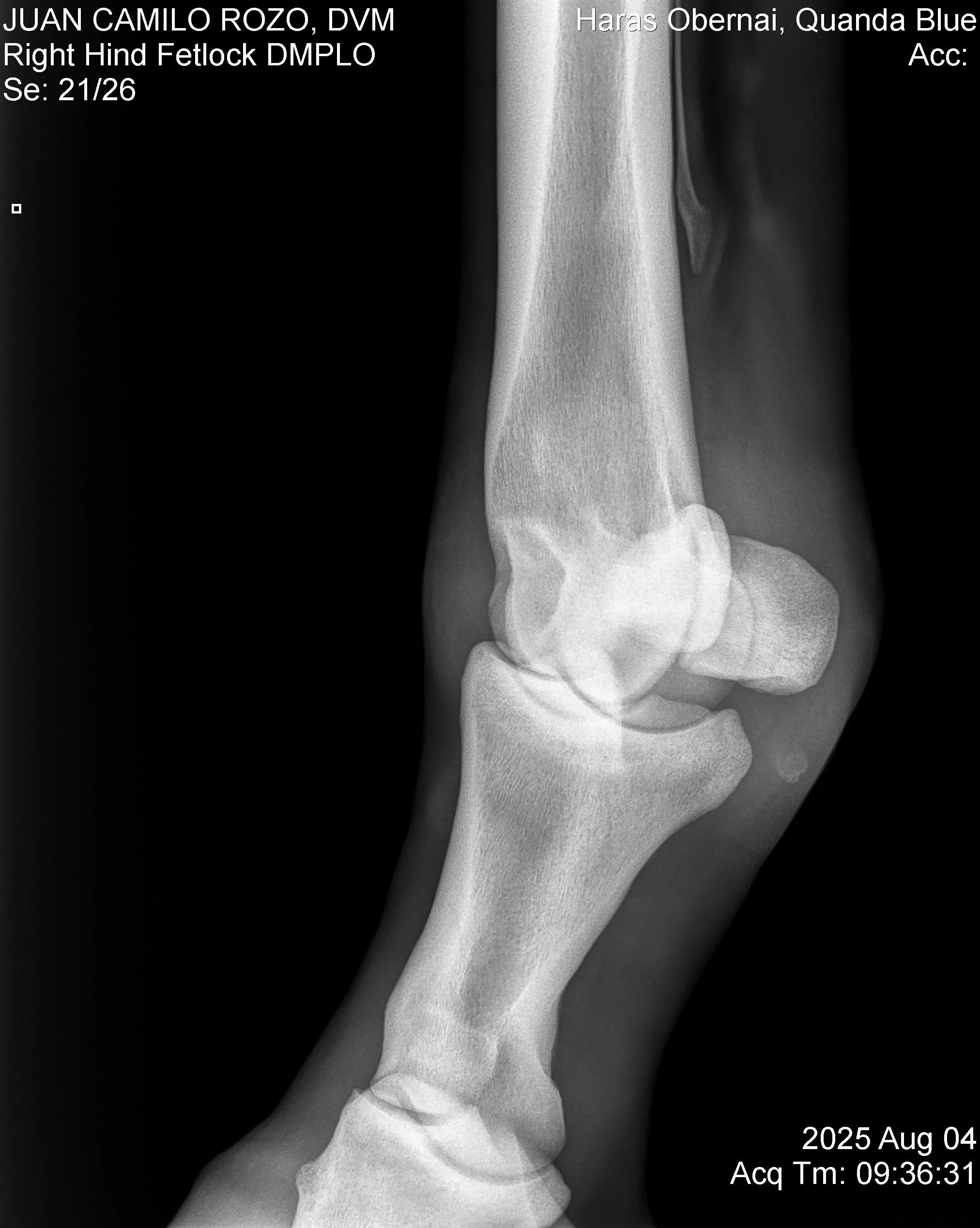 Right Hind Fetlock DMPLO.jpg