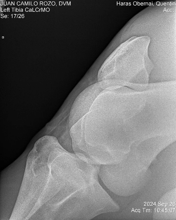 Left Tibia CaLCrMO.jpg